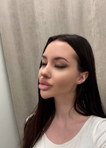 Лисса, Г. Асбест